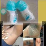 Temoignage-anti-transpirant-150x150